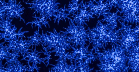 blue.yeast.bleu.jpg 